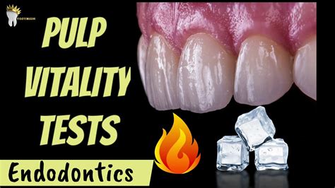 what is pulp vitality test